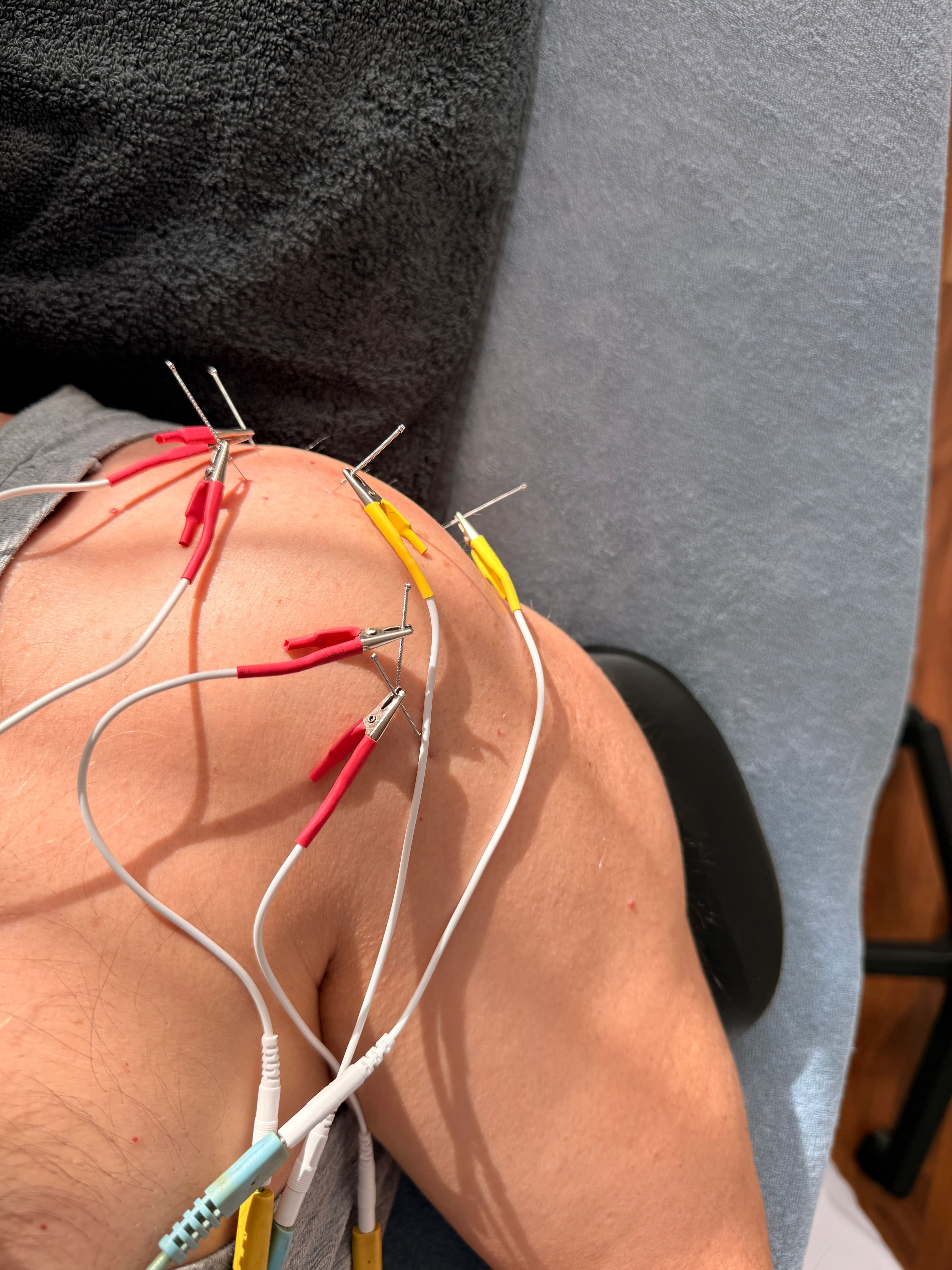 Therapiesitzungen